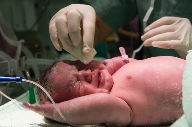 Cesarean (C-Section) Delivery in fatehpur shekhawati