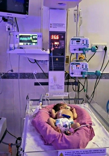 Newborn Baby Recovers After Breathing Problems