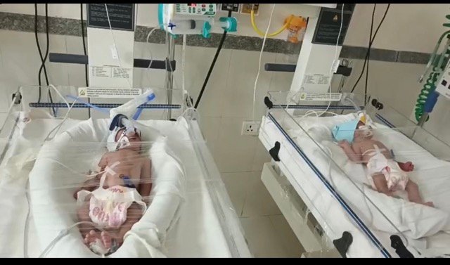 Premature Twins Needed NICU Care After Normal Delivery